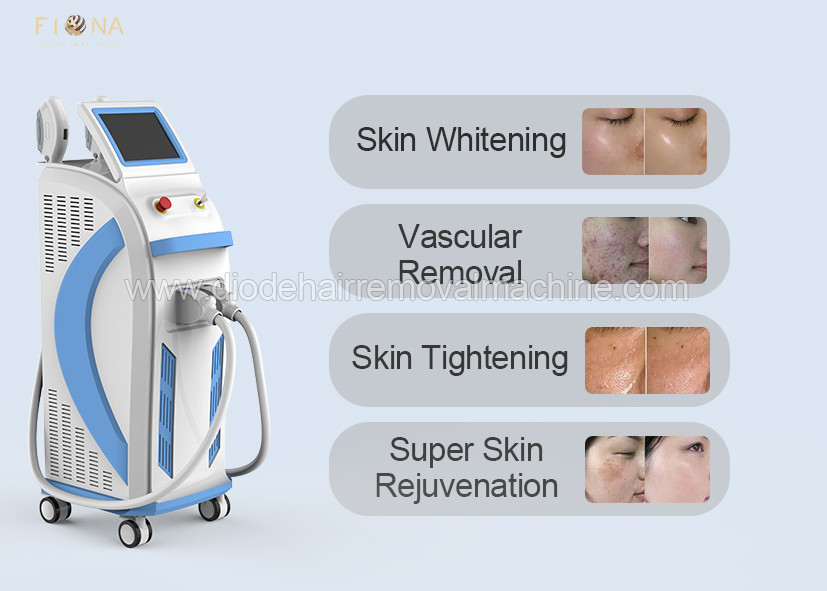 Quality FL-260S Opt Shr Hair Removal Machine Beauty Facial Machine For Facial Pigmentation for sale