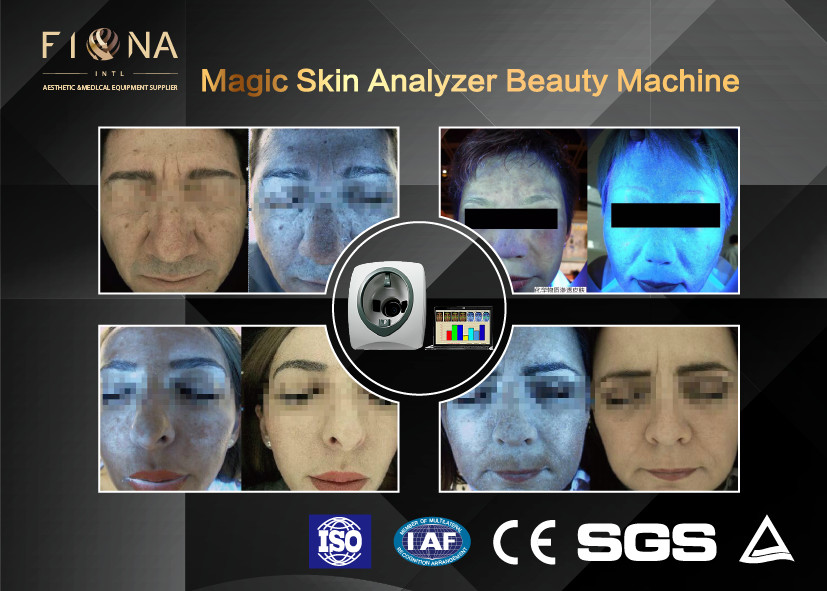 Quality Uv Light Facial Skin Analyser Machine Multi Function 50HZ For Age Test for sale