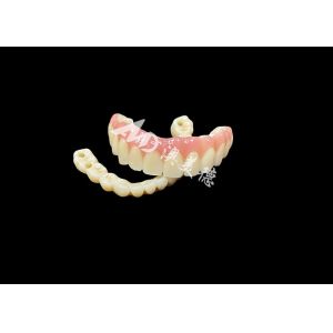 Quality Implant supported dentures Bridge The Ultimate Dental Solution For Missing Teeth for sale