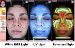 UV RGB Light Facial Skin Analysis BS-3200 Skin Analyzer