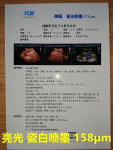 Quality 125 Microns White Base Opaque Inkjet Medical Film Three Dimensional CT Scan Film for sale