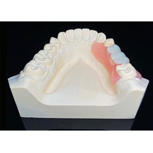 OEM Invisible Removable Dentures Custom Acrylic Resin Partial Dental Prosthesis