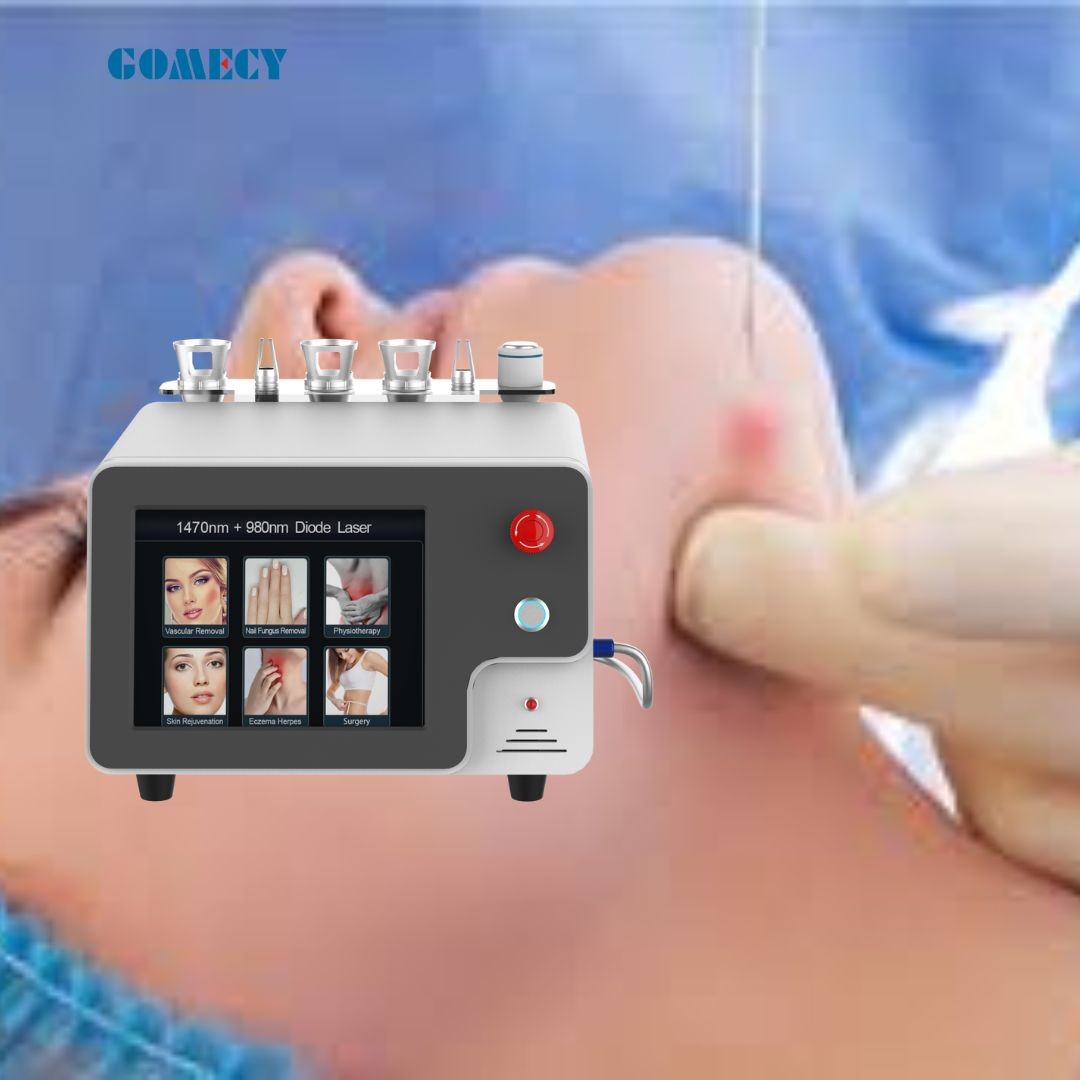 980 1470Nm Vaser Laser Plastic Surgery Laser Machine Liposuction Facelift Laser For Sale