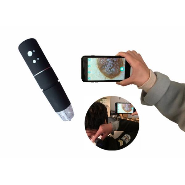 WIFI Skin Analyer Digital Video Dermatoscope Skin Watcher With 2 Million Pixels