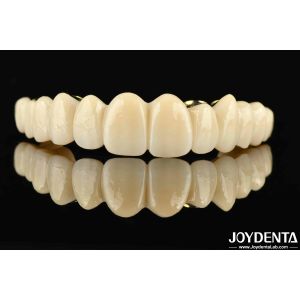 Quality Custom-made Ti-Bar Zirconia Hybrid Bridge The Perfect Combination For Comfort And Functionality for sale