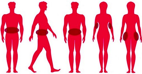 Dual Handle Fat Freezing Cellulite Weight Loss Machines CR02 110v / 220v