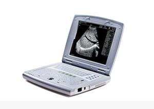 Buy Portable Baby Ultrasound Machine Portable Ultrasound Scanner for Pediatrics at wholesale prices
