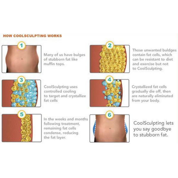 Portable Body Sculpting Cryolipolysis Slimming And Weight Loss Machine