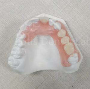 Quality Pink / Transparent TCS Valplast Odor Resistant Flexible Dental Prosthesis for sale