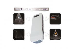 China Color Doppler Sonography Color Doppler Ultrasound Scanner With Built-in WiFi Signal Wireless Charging 2.5MHz~10MHz Freq on sale