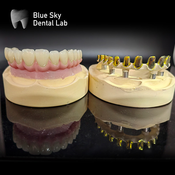 Screw retained MUA abutment Implant Cases Zirconia crowns Multilayer pink porcelain with Easy repair
