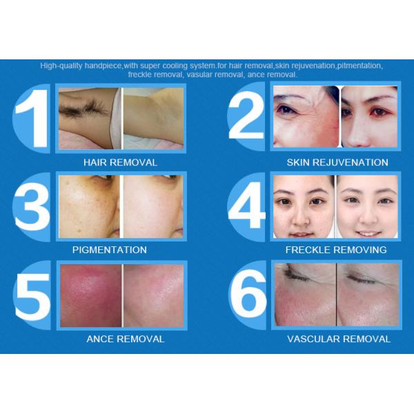 Home IPL Laser Machine Portable Type Double Wavelengths Coating Quick Shooting