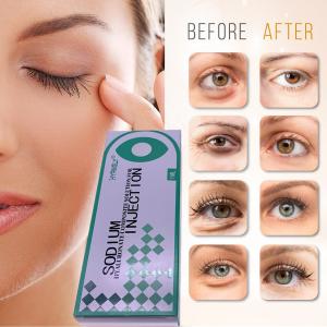 Quality Removing Dark Circles 1ml Hyaluronic Acid Dermal Filler By Injecting for sale