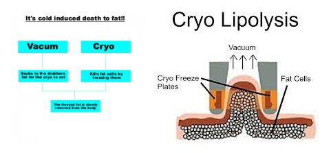 Reduce Cellulite Fat Freeze Cryolipolysis Slimming Device With Touch Screen RF Cavitation