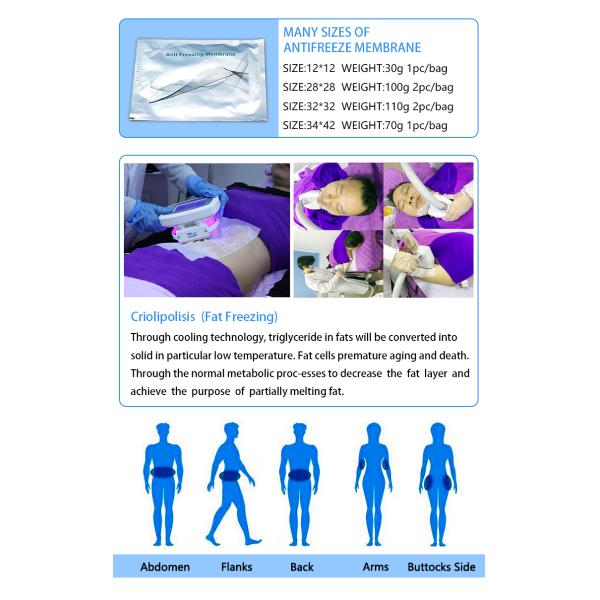 Dual Handle Fat Freezing Cellulite Weight Loss Machines CR02 110v / 220v