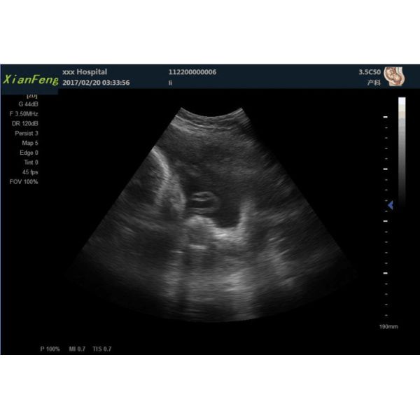 FSC 3D 4D MSK Portable Ultrasound Machines Scan Trans Vigianl