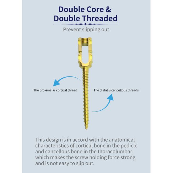 Titanium 5.5mm Double Threaded Pedicle Screws Insert Spine Fixation Device