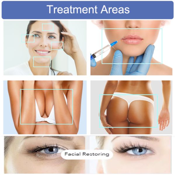 Non Allergic Anti Aging Breast Enlargement Injection For Medium Wrinkles